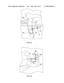 ARM POSITIONING AND SUSPENSION ASSEMBLY diagram and image