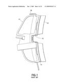 End Stabilization for Brake Shoes Extending Beyond the Ends of the Brake Head diagram and image