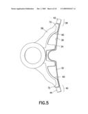 End Stabilization for Brake Shoes Extending Beyond the Ends of the Brake Head diagram and image