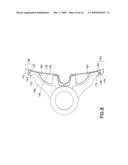 End Stabilization for Brake Shoes Extending Beyond the Ends of the Brake Head diagram and image