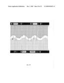 ION CONCENTRATION TRANSISTOR AND DUAL-MODE SENSORS diagram and image