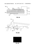 Diluted magnetic semiconductor nanowires exhibiting magnetoresistance diagram and image