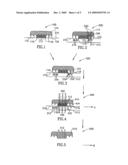 Oral Implant Template diagram and image