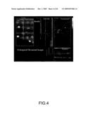 Diagnostic system for multimodality mammography diagram and image