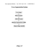 Diagnostic system for multimodality mammography diagram and image