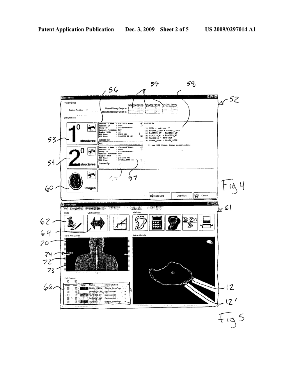 SYSTEM FOR ASSESSING RADIATION TREATMENT PLAN SEGMENTATIONS - diagram, schematic, and image 03