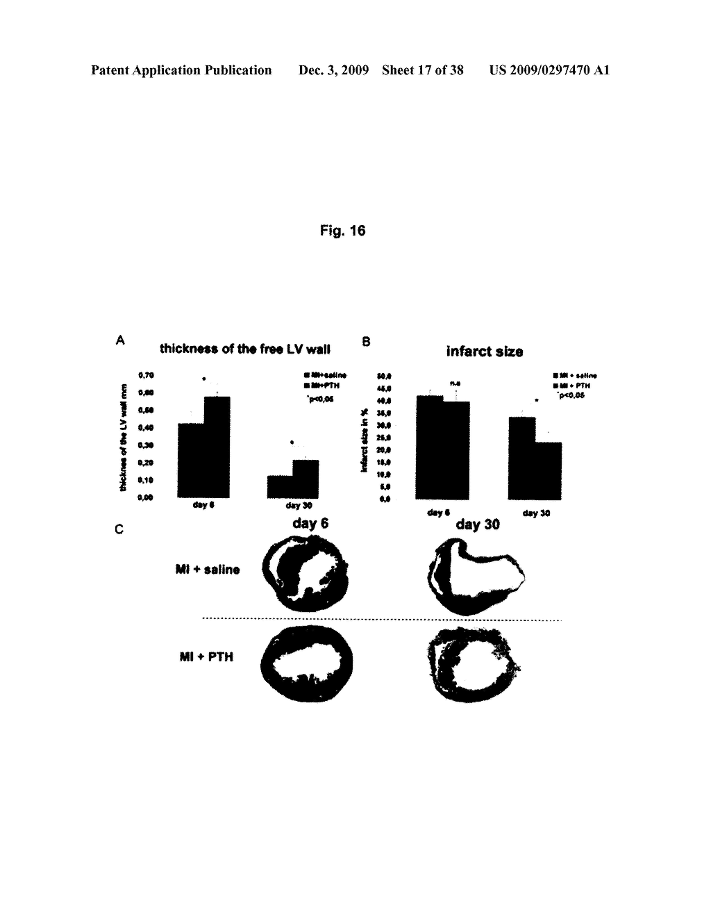 REMEDIES FOR ISCHEMIA - diagram, schematic, and image 18