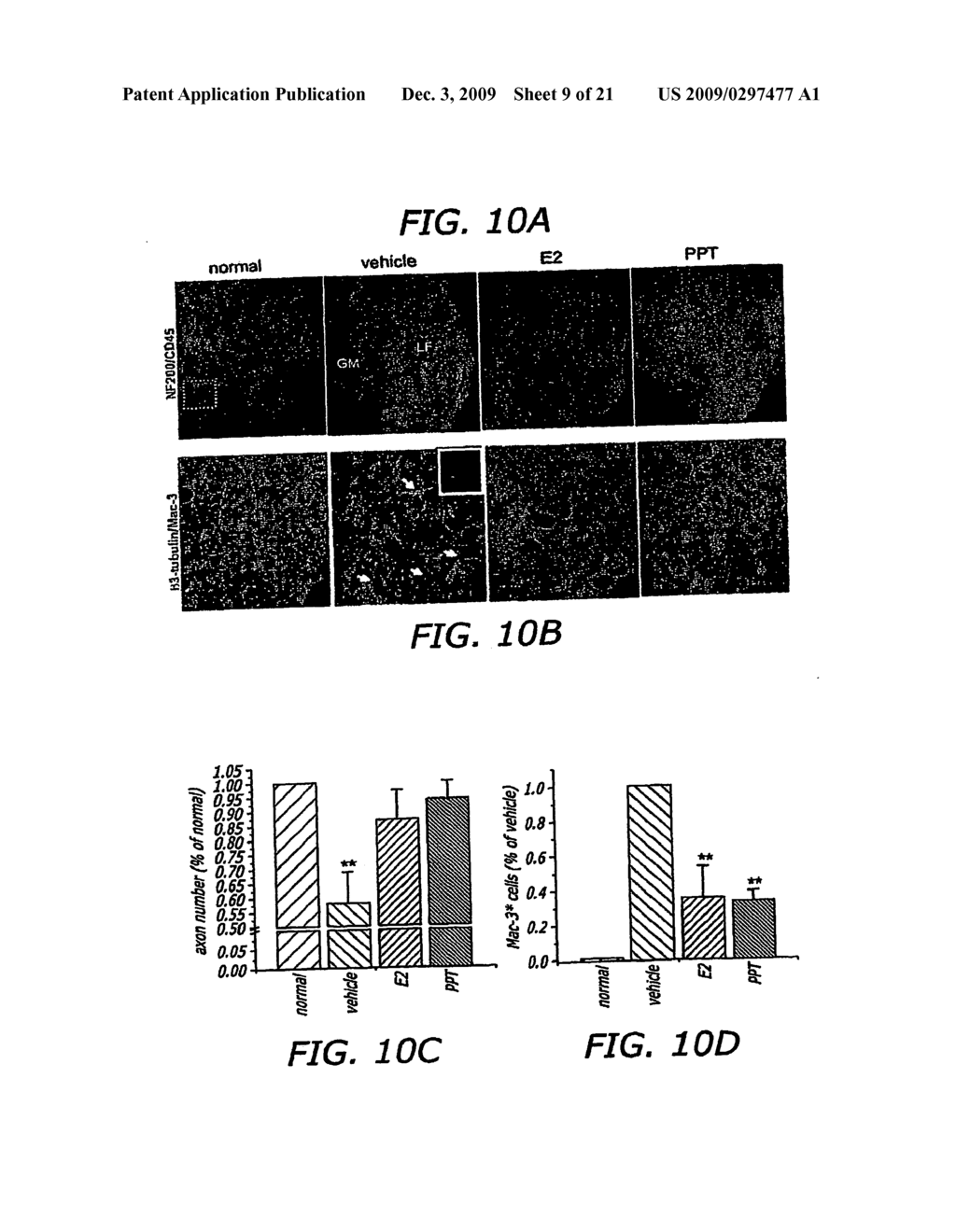 Estriol Therapy for Autoimmune and Neurodegenerative Disease and Disorders - diagram, schematic, and image 10