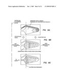 METHODS OF USING REGENERATIVE CELLS IN THE TREATMENT OF PERIPHERAL VASCULAR DISEASE AND RELATED DISORDERS diagram and image