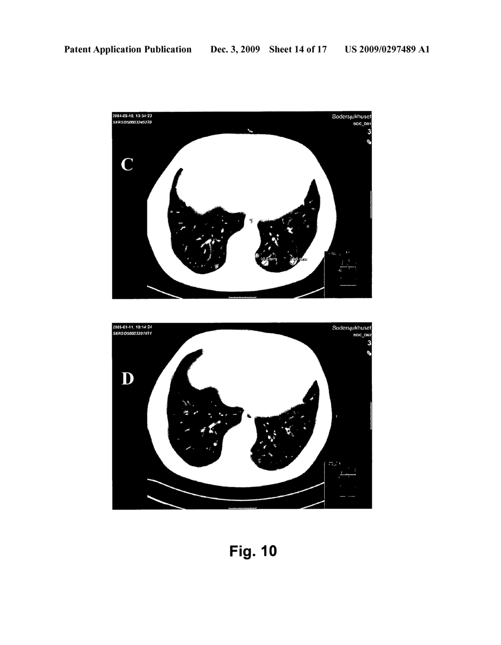 Method for Expansion of Tumour-Reactive T-Lymphocytes for Immunotherapy of Patients with Cancer - diagram, schematic, and image 15