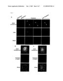 NON-SMALL CELL LUNG CANCER-RELATED GENE, ANLN, AND ITS INTERACTION WITH RhoA diagram and image