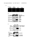 NON-SMALL CELL LUNG CANCER-RELATED GENE, ANLN, AND ITS INTERACTION WITH RhoA diagram and image