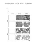 NON-SMALL CELL LUNG CANCER-RELATED GENE, ANLN, AND ITS INTERACTION WITH RhoA diagram and image