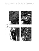 CCR2 ANTAGONISTS FOR CHRONIC ORGAN TRANSPLANTATION REJECTION diagram and image