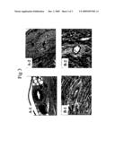 CCR2 ANTAGONISTS FOR CHRONIC ORGAN TRANSPLANTATION REJECTION diagram and image