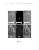 Chloroplast-derived human vaccine antigens against malaria diagram and image