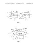 INTERSPINOUS DYNAMIC STABILIZATION SYSTEM WITH ANISOTROPIC HYDROGELS diagram and image