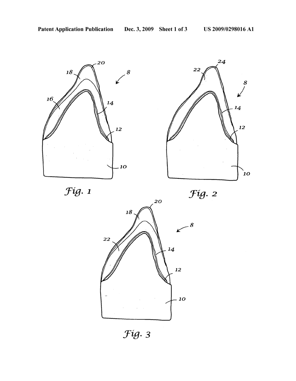 Integrated porcelain system for a dental prosthesis - diagram, schematic, and image 02