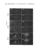 Pancreatic and Liver Endoderm Cells and Tissue by Differentiation of Definitive Endoderm Cells Obtained from Human Embryonic Stems diagram and image