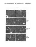 C-Reactive Protein and Its Use to Treat Systemic Lupus Erythematosus and Related Conditions diagram and image