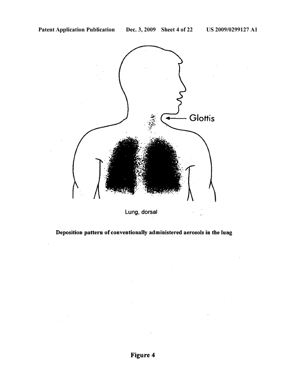 Magnet-Field Controlled Active Substance Transfer for Aerosol Therapy - diagram, schematic, and image 05