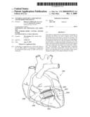 VENTRICULAR INFARCT ASSIST DEVICE AND METHODS FOR USING IT diagram and image