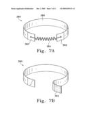 VENTRICULAR INFARCT ASSIST DEVICE AND METHODS FOR USING IT diagram and image