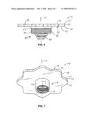 Gear-Shaped Lifting Cap for a Laryngoscope diagram and image