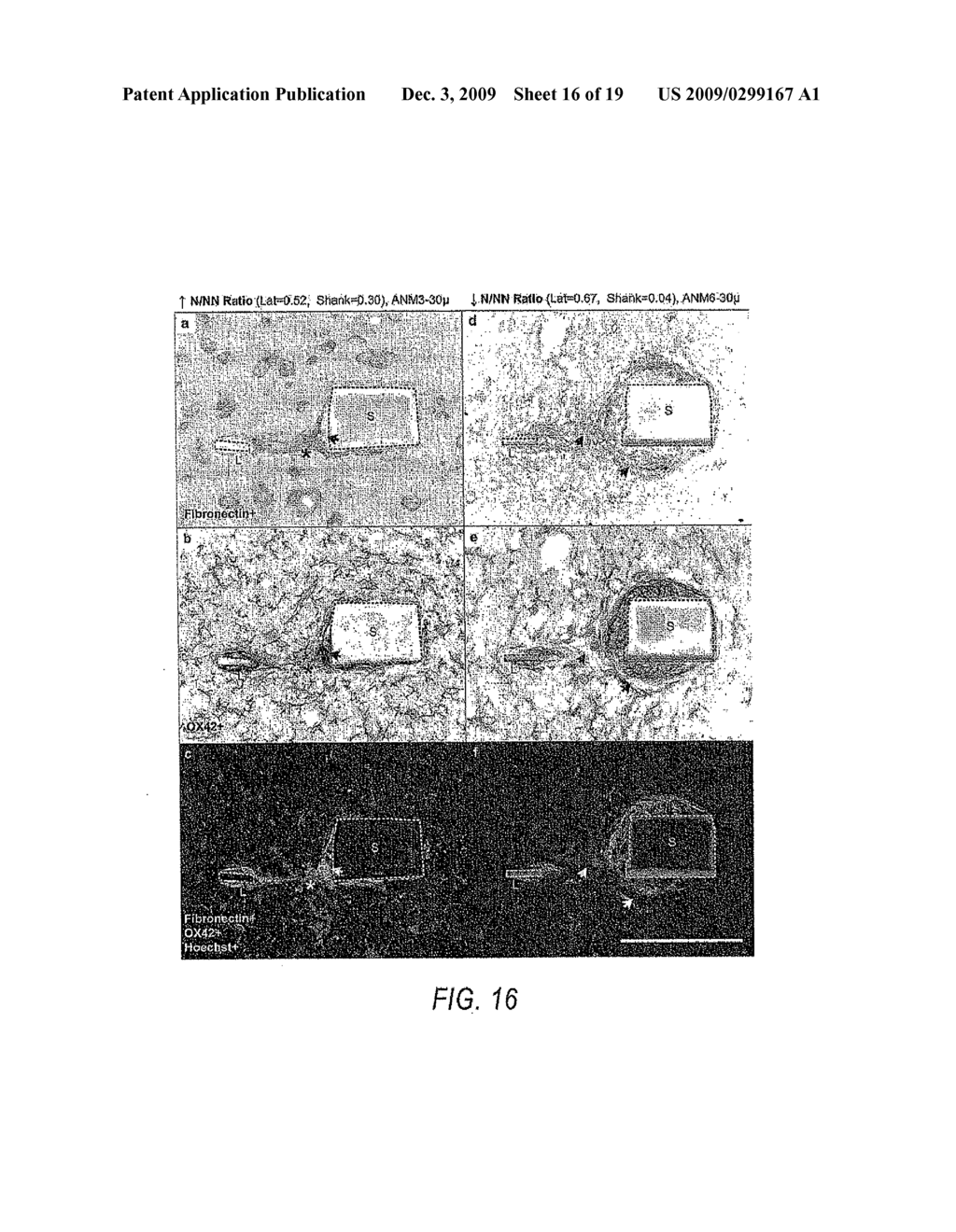 MICROELECTRODE WITH LATERALLY EXTENDING PLATFORM FOR REDUCTION OF TISSUE ENCAPSULATION - diagram, schematic, and image 17