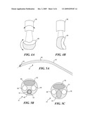 ULTRASOUND BASED METHOD AND APPARATUS TO DETERMINE THE SIZE OF KIDNEY STONE FRAGMENTS BEFORE REMOVAL VIA URETEROSCOPY diagram and image