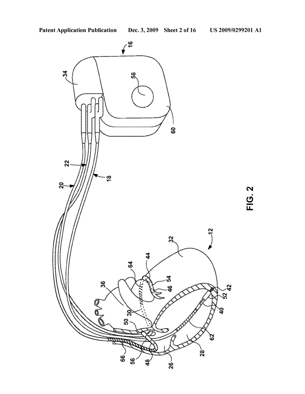 ELECTRODE LEAD INTEGRITY REPORTS - diagram, schematic, and image 03