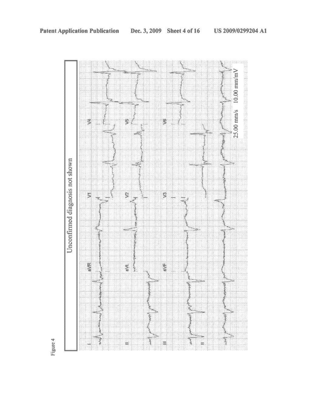 MOBILE- AND WEB-BASED 12-LEAD ECG MANAGEMENT - diagram, schematic, and image 05