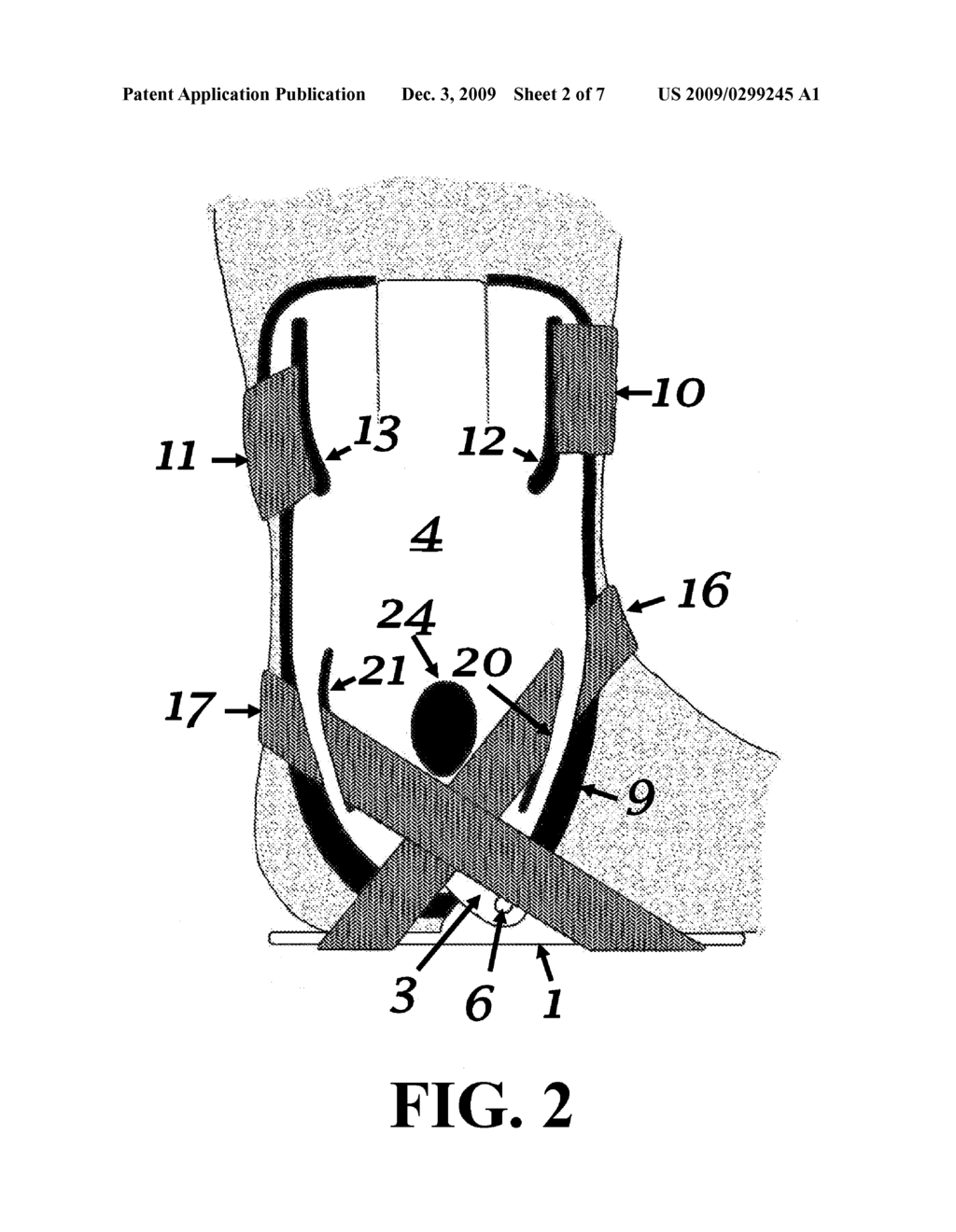 Ankle Brace Design for Optimal Fit to Either Right or Left Extremity Contours - diagram, schematic, and image 03