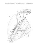 REDUCED-PRESSURE, COMPRESSION SYSTEMS AND APPARATUSES FOR USE ON A CURVED BODY PART diagram and image