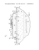 REDUCED-PRESSURE, COMPRESSION SYSTEMS AND APPARATUSES FOR USE ON A CURVED BODY PART diagram and image