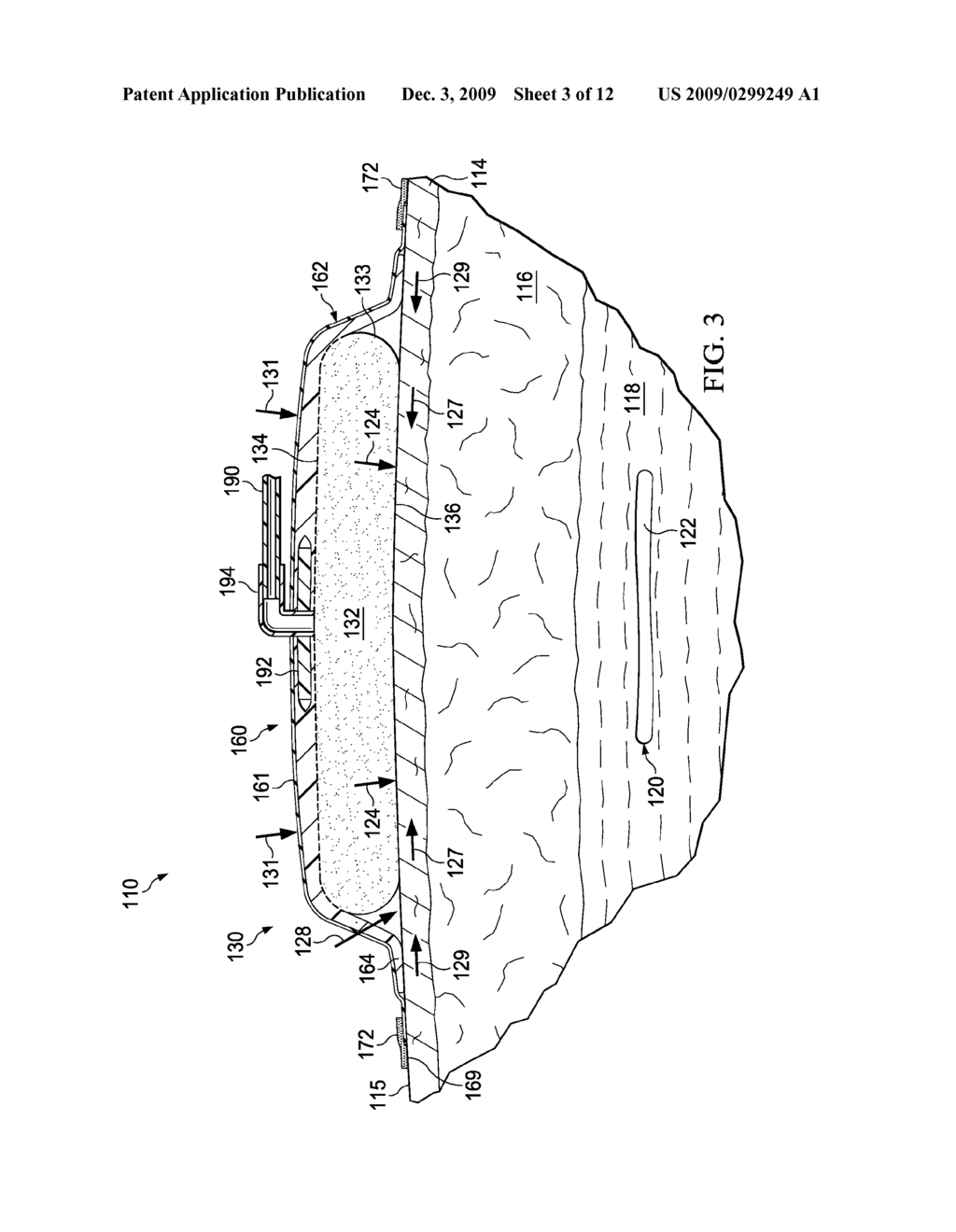 REDUCED-PRESSURE, COMPRESSION SYSTEMS AND APPARATUSES FOR USE ON A CURVED BODY PART - diagram, schematic, and image 04