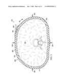 REDUCED-PRESSURE, COMPRESSION SYSTEMS AND APPARATUSES FOR USE ON A CURVED BODY PART diagram and image