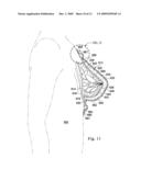 REDUCED-PRESSURE, COMPRESSION SYSTEMS AND APPARATUSES FOR USE ON A CURVED BODY PART diagram and image