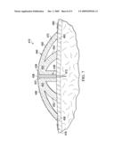 SEE-THROUGH, REDUCED-PRESSURE DRESSINGS AND SYSTEMS diagram and image