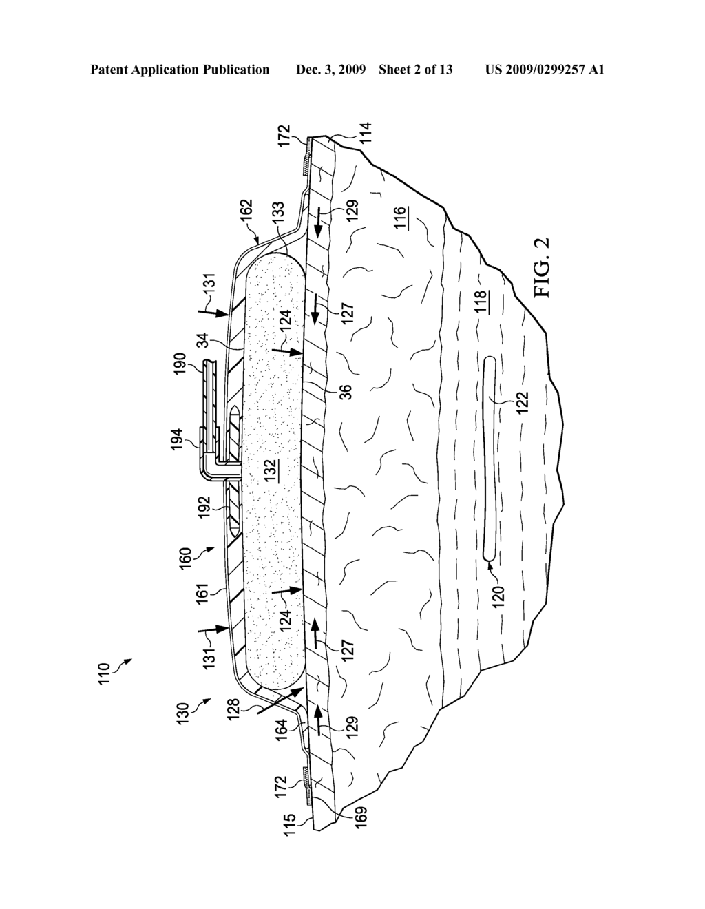 REDUCED-PRESSURE SURGICAL WOUND TREATMENT SYSTEMS AND METHODS - diagram, schematic, and image 03