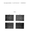 Topical Aminolevulinic Acid-Photodynamic Therapy for the Treatment of Acne Vulgaris diagram and image