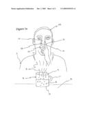 COLD TREATMENT diagram and image