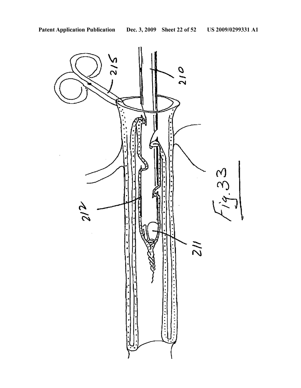 Vein stripping device - diagram, schematic, and image 23