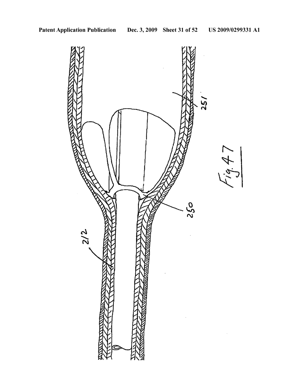 Vein stripping device - diagram, schematic, and image 32