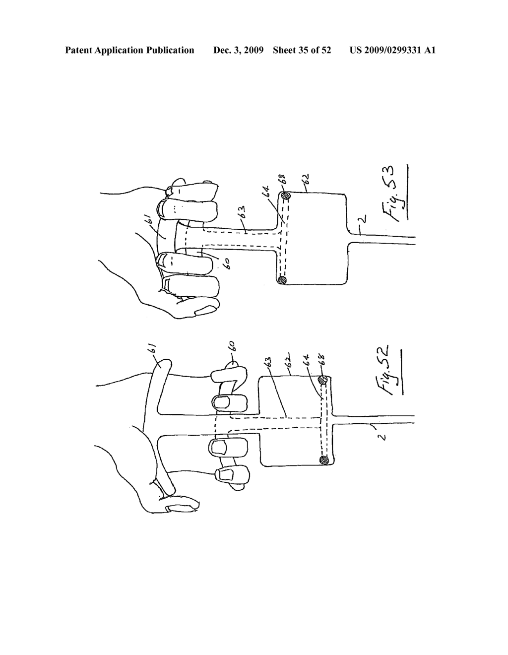 Vein stripping device - diagram, schematic, and image 36