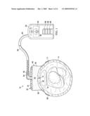 REDUCED PRESSURE, COMPRESSION SYSTEMS AND APPARATUSES FOR USE ON JOINTS diagram and image