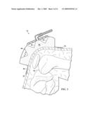 REDUCED PRESSURE, COMPRESSION SYSTEMS AND APPARATUSES FOR USE ON JOINTS diagram and image