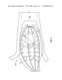 Electrical mapping and cryo ablating with a balloon catheter diagram and image