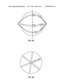 Electrical mapping and cryo ablating with a balloon catheter diagram and image