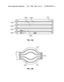 Electrical mapping and cryo ablating with a balloon catheter diagram and image